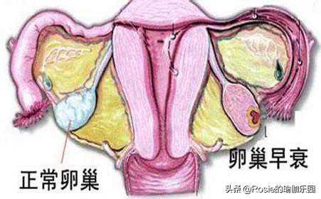 怀孕六周多香港验血,这些不良生活方式可能导致不孕不育！备孕过程中你还在