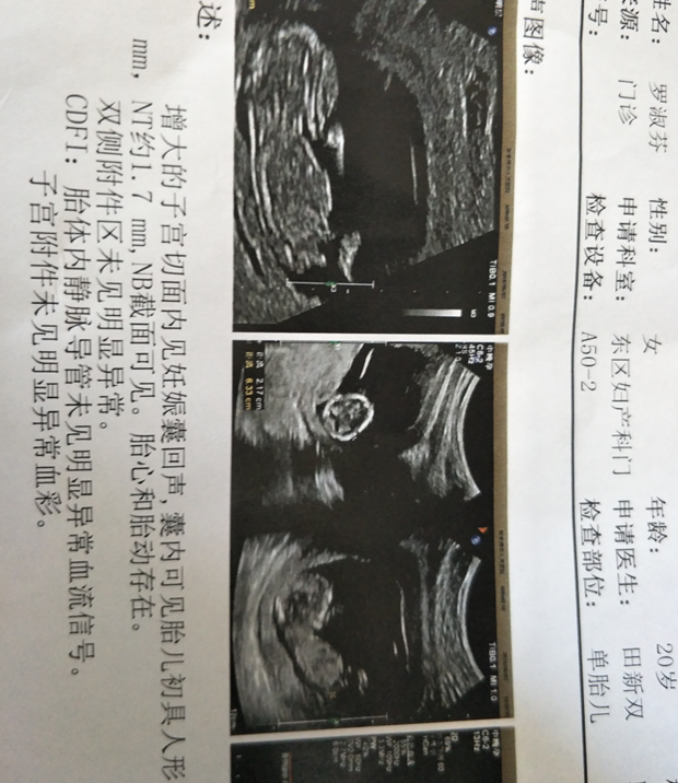 香港最大的验血机构,输卵管不通导致不孕，备孕期间使用这个方，已怀孕，附