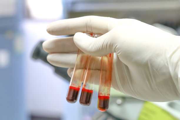 香港宝仁医疗验血多少钱,精准的香港验血单位查验保证