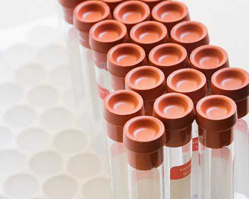 香港验血动脉血准吗_香港验血哪里可以做_需要预约吗具备什么条件