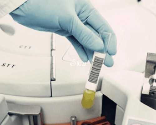 香港验血鉴定男女怎么检测_听朋友说香港验血有不准的_鉴定性别真的靠谱吗