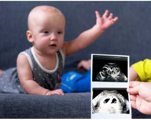 香港验血复检重测会影响准确性吗_达雅高几点出结果_DNA检测都需要哪些条件