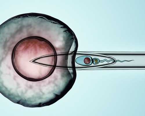 无创dna可以代替唐筛吗-供卵代生助孕