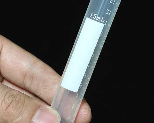 如何治子宫肌瘤?子宫肌瘤选择什么方式治疗?-本地助孕机构