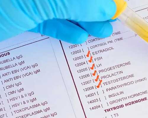 灯泵浦激光器_国外报告认为中国艺术市场疲态尽显