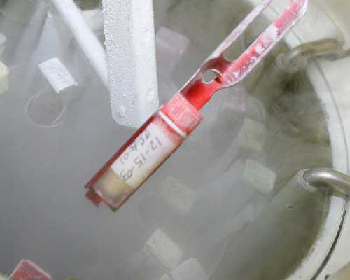 移植前暖宫有助于着床 暖宫贴对怀孕着床有什么好处