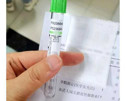 香港验血一定要满7周吗_香港验血生了的准吗_验血查男女哪个验机构准!