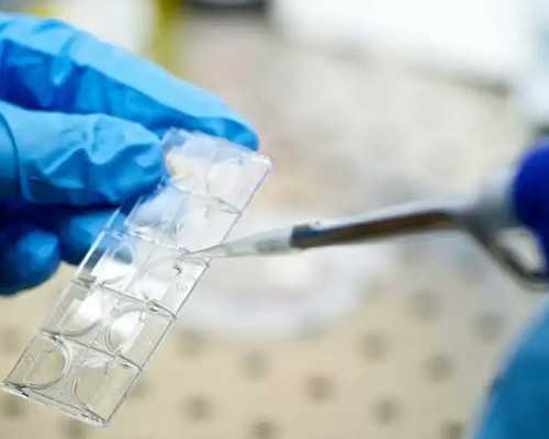 香港验血中介机构哪家为_品质优良的香港验血_流程手续如何办理