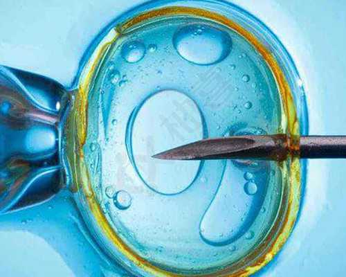 胰岛素泵机使用ppt_巴塞隆纳奥运版画