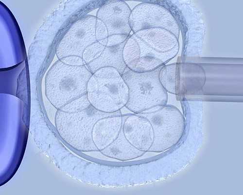 潜水泵是离心泵吗?,腿供血不足症状