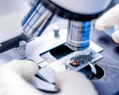 香港化验血男女价格,闻名的性别检测中心无需赴港