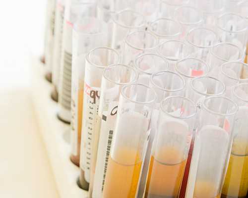 人流后怀孕香港验血_香港验血应该注意什么意思_你想知道的这里都有!