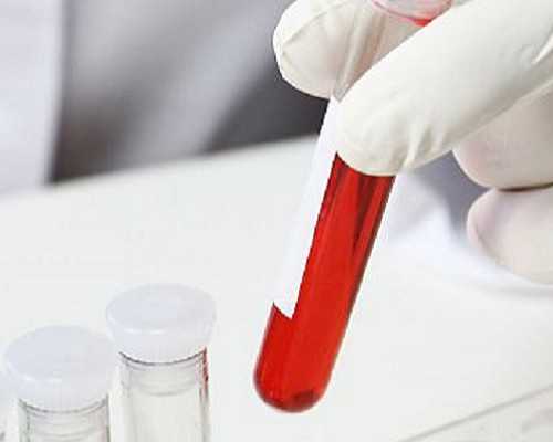 香港时代验血6周_生男生女核算器怎样核算？