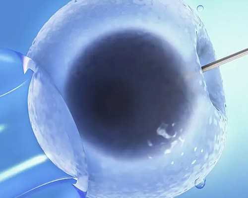 香港达雅高验血hkv服务机构_6周多香港验血准不准_查男女的真相在这里