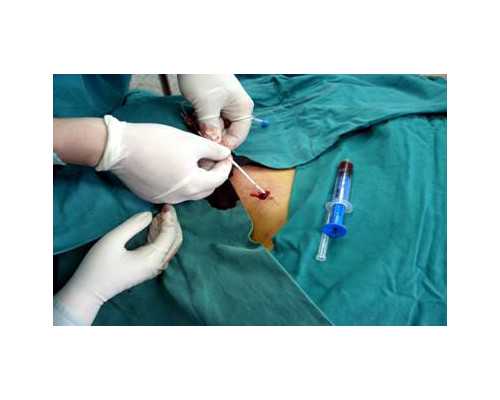 网上预约香港验血靠谱吗_香港验血dna查询_真的准确吗!