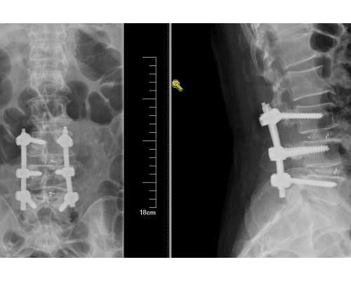 香港验血寄血过了一星期了_苏州验血测男女_验血和B超都是男孩会翻盘吗