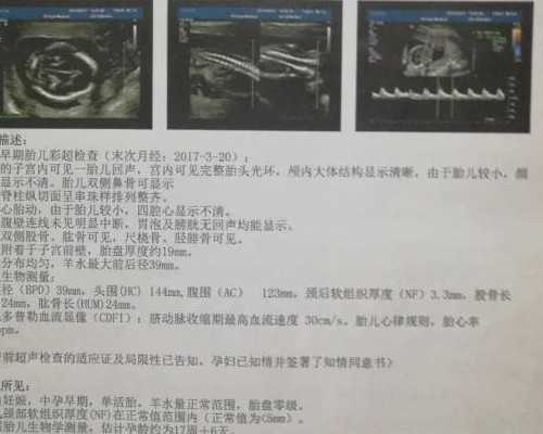 香港圣玛丽医院验血,去香港验血宝宝要多大_验血查性别真的靠谱吗!
