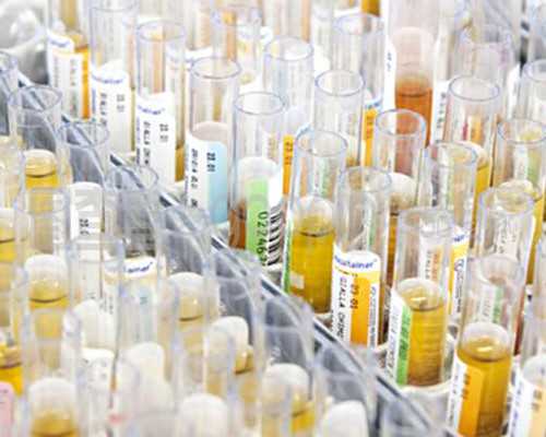 去香港验血测男女大概费用多少,备孕二胎想生女宝吃什么