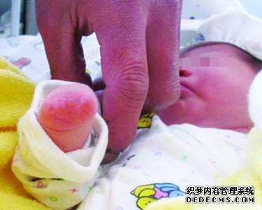 香港验血男孩女孩价格_香港验血判定胎儿性别靠谱吗？接好孕健康宝宝！