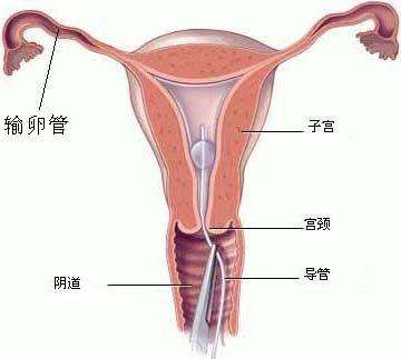 怀孕36天香港可以验血写,说说我们夫妻的试管婴儿之路，女人不能自然怀孕她的